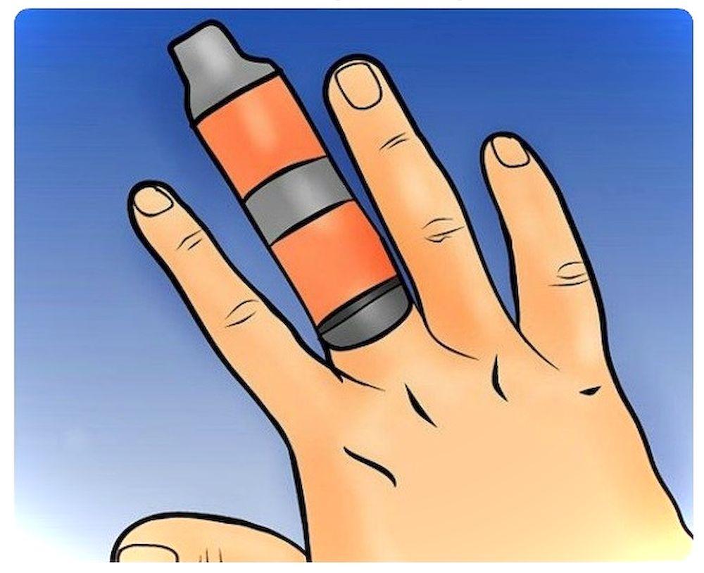 Что делать, если сломал палец на руке?