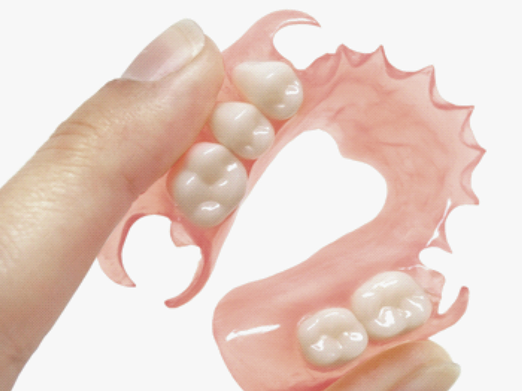 Съемный протез (6-14 зубов) термо Джет. Нейлоновый микропротез 1-3 зуба.