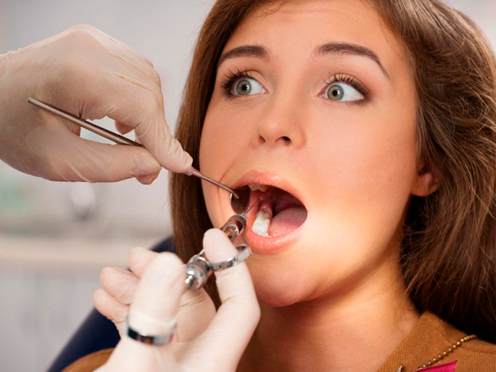 Как проявляется альвеолит после удаления зуба