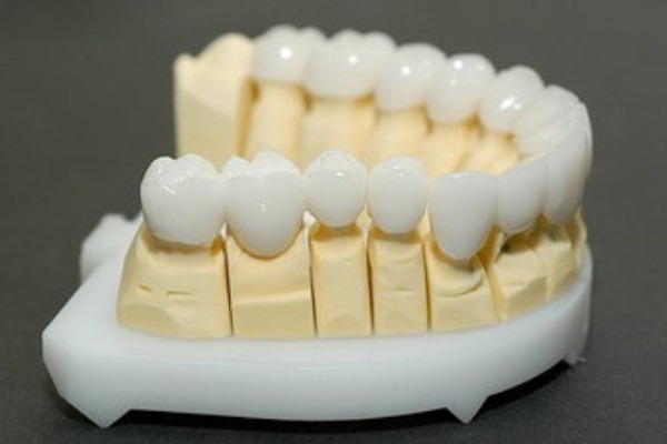 зубные коронки