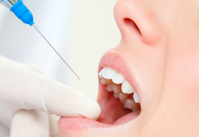Обезболивание в стоматологии и лечение под наркозом