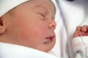 Угревая сыпь у новорожденных