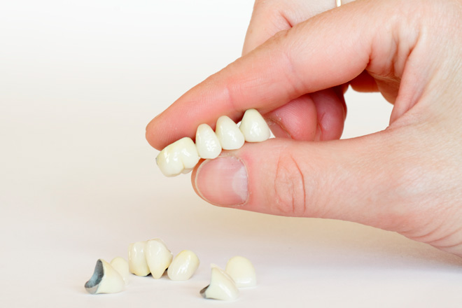 оксид циркония на передние зубы