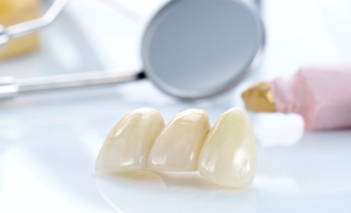 Виды зубных протезов