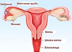 признаки внематочной беременности