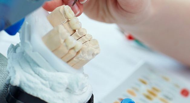 ремонт зубного протеза