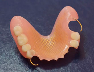 Частичное съемное протезирование зубов
