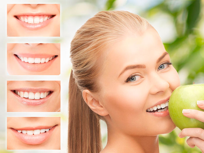 Методы восстановления зубов