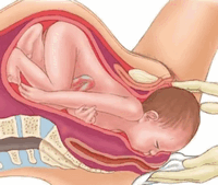 инфицирование ребенка при рождении