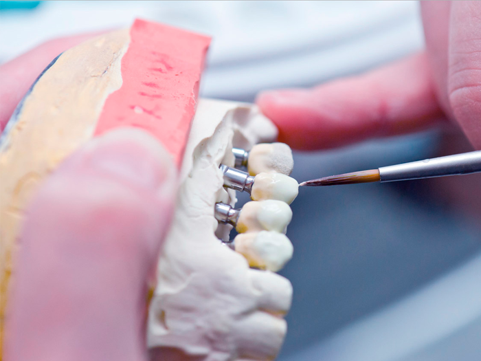 Как быстро привыкнуть к зубному протезу