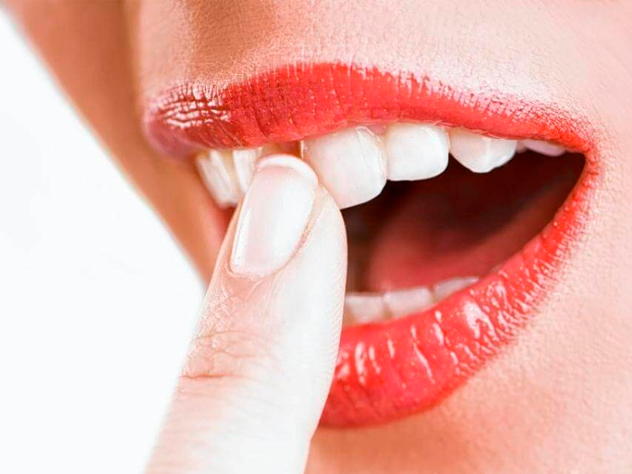 Как укрепить шатающиеся зубы в домашних условиях