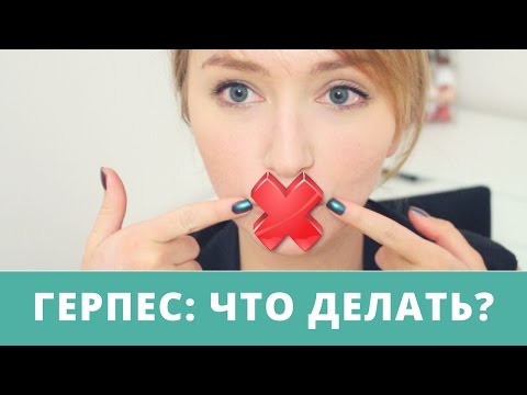 Самые эффективные лекарства для лечения герпеса на губах: таблетки и мази