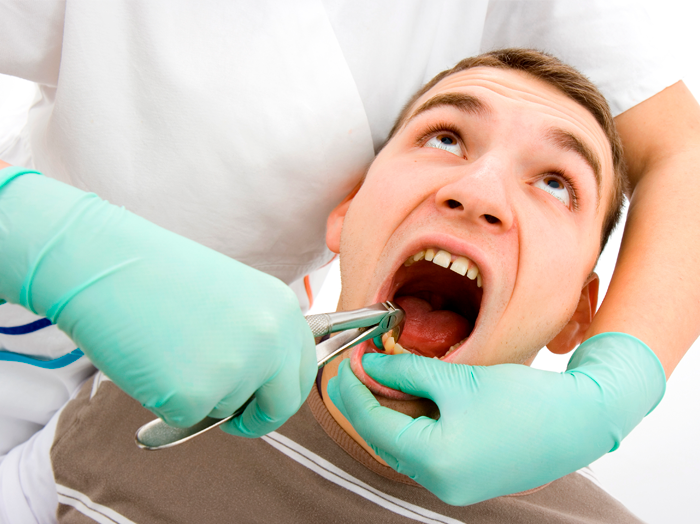 Чем и как полоскать рот после удаления зуба