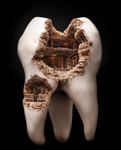 Классификация кариеса зубов