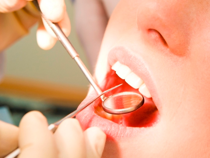 Рекомендации до и после ультразвуковой чистки зубов