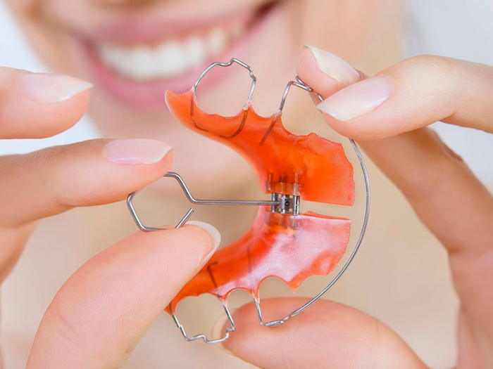 Ортодонтические пластины для выравнивания зубов