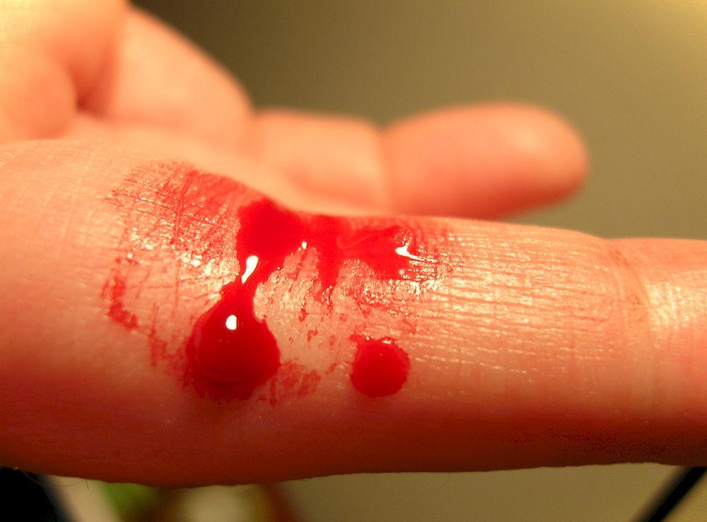 Как остановить кровь из пальца в домашних условиях