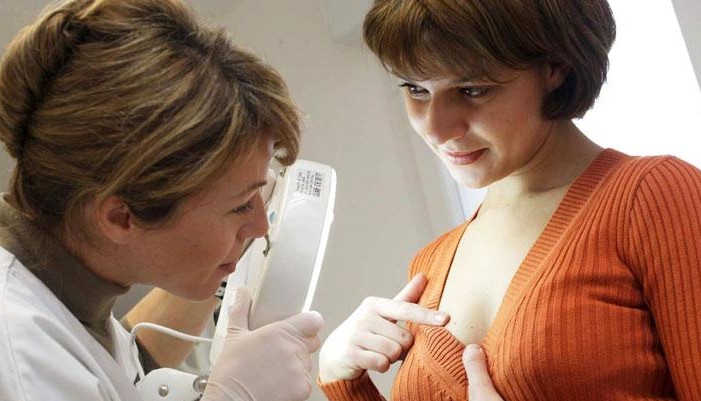 папилломы под грудью у женщин, лечение