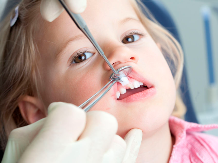 Порядок прорезывания постоянных зубов у детей