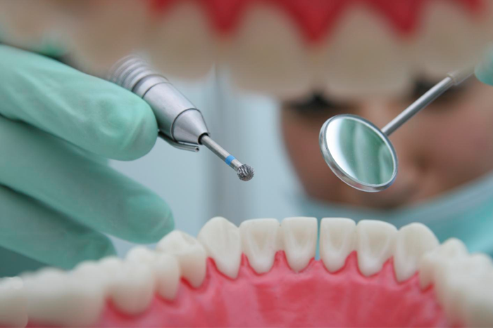 Почему болит зуб после пломбирования
