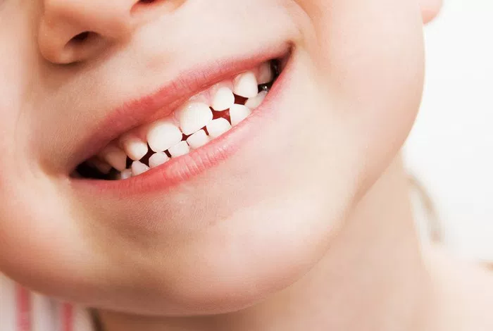 удаление молочных зубов